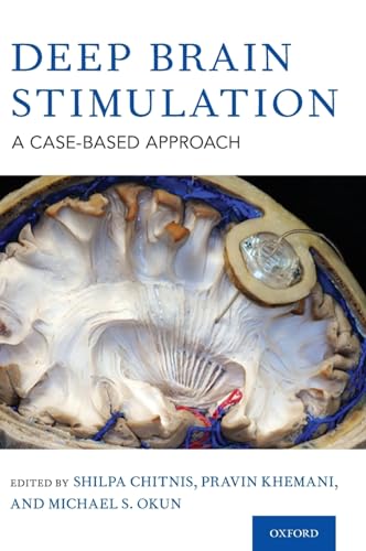 Deep Brain Stimulation: A Case-Based Approach