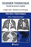 SCANNER THORACIQUE. GUIDE DE LECTURE RAPIDE: IMAGE CELFS. DEFINITION ET ETIOLOGIES