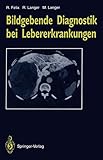 Bildgebende Diagnostik bei Lebererkrankungen (German Edition)