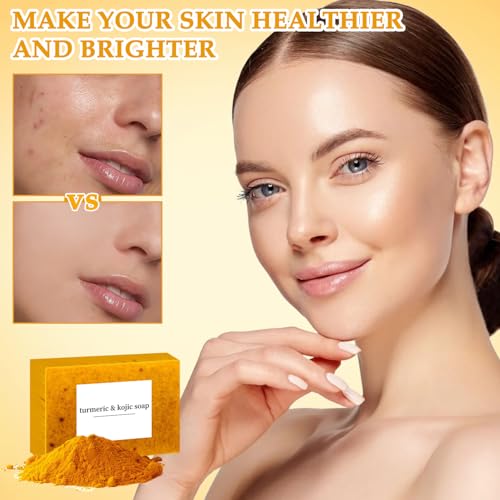 Nicgou Lemon Turmeric Soap, Turmeric Soap Bar for Face ＆ Body, Natural turmeric Handmade soap for All Skin Types (3pcs)