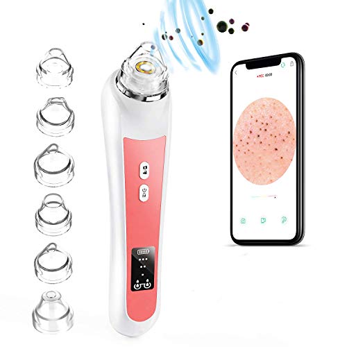 Blackhead Remover Vacuum,Sinohrd WiFi Visual Facial Pore Cleanser Pimple Sucker 1080P HD 20X