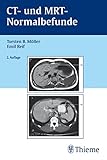 CT und MRT Normalbefunde: . Zus.-Arb.: T. B. Möller, E. R. Reif