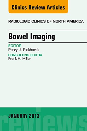 Bowel Imaging, An Issue of Radiologic Clinics of North America (The Clinics: Radiology Book 51) (English Edition)