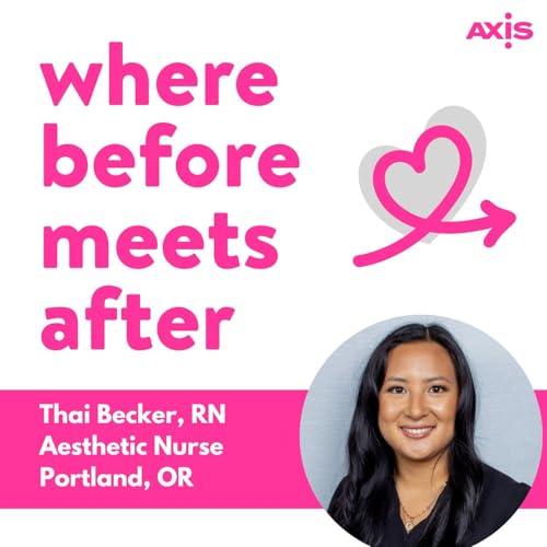 How much filler can you get in a day? [Thai Becker, RN, Portland]
