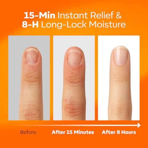 modelones Cuticle Oil Pen Rose for Growth and Strength Nail Growth Oil Cuticle Softener Quick Dry Nail Care Moisturize and Strengthen Damaged Nails 10ml 0.34Fl Oz — view 2
