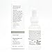 The Ordinary Niacinamide 10% + Zinc 1% | 30 ML | 1 OZ NEW GENERATION