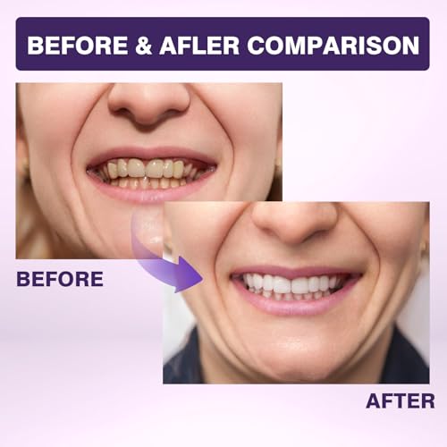 1 Flasche Hydroxylapatit Zahnpasta Zahnputztabletten Zahnpasta Hydroxylapatit Tabletten Hydroxyapatite Zahnpasta Toothpaste Zahnpasta Mit Hydroxylapatit Toothpaste Tablets Etwa 62 Tabs – Bild 6