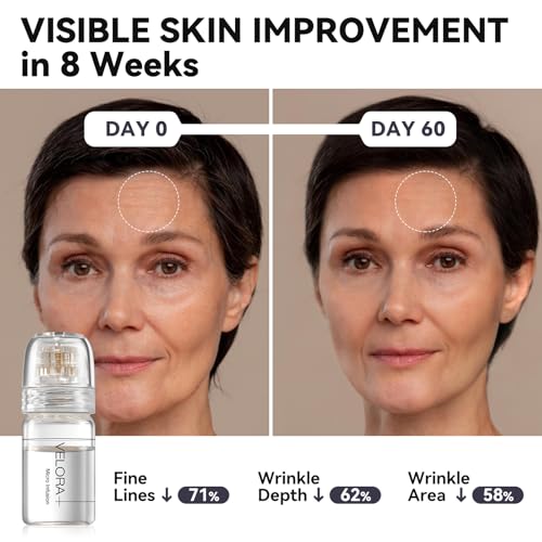 VELORA Micro Infusion System for Face - Hydrating Peptide & Hyaluronic Acid Serum Set, Skin-Smoothing Radiance Set with 0.25mm Stamp, At-Home Facial Kit (3 Month)