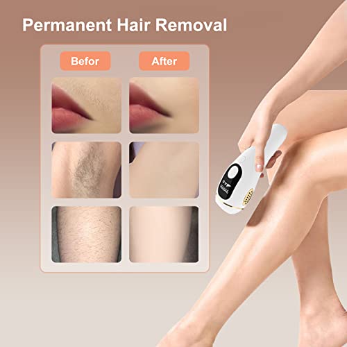 IPL Hair Removal Device, Model S1-A, For Women & Men At-Home, For Armpits Back Legs Arms - Thumbnail 6