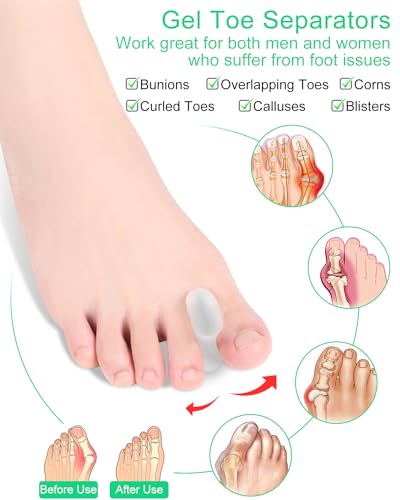 12 pack gel toe separators silicone toe spacers for women men bunion corrector toe pain relief toe alignment soft toe spacer for crooked toes overlapping toes hammertoe correction large