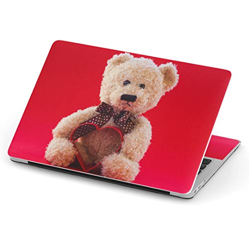 igsticker MacBook Air 13inch 2018 2019 2020 f / A1932 pXLV[ }bNubN GA Mac 13" C` Retina pV[ tB XebJ[ ANZT[ ی (2010N 