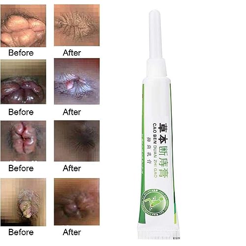 Semme Ointment Cream, Piles Cream For Internal Piles External Anal Fissure (1 Pcs Pack) #TOP4