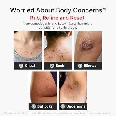 ثنائي العناية بالجسم بتفتيح البشرة بحمض الكوجيك من medicube: مقشر الجسم بالكركم وغسول الجسم بحمض الكوجيك | لتفتيح البشرة وتقشيرها برائحة الحمضيات للحصول على روتين استحمام منعش