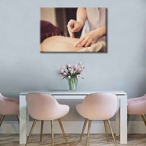 Image of TUMOVO Physical Therapists do Acupuncture Canvas Wall Art Traditional Chinese Medicine Canvas Photo 1 Panels Prints for Wall Decor Giclee Print Gallery Packaging Artwork Ready to Hang (16 inch Wx24 H)