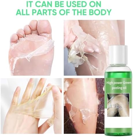 Peeling Oil for Dark Skin Green Peeling Oil Solution Extra Strength Exfoliate Body Extra Strong Exfoliating Peels for Hand Feet Dark Knuckle Knee Elbow Chemical Peel Body for All Skin Type 3.38 FLOZ