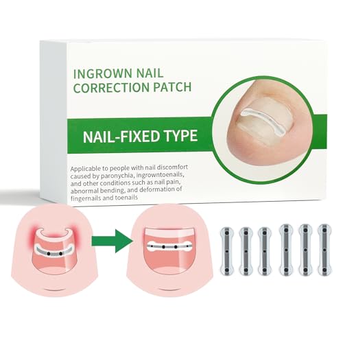 Titanium Alloy Ingrown Toenail Treatment, Ingrown Toenail Removal Kit for Curved Nail Repair, Nail Tools, Ingrown Nail Tool for Home Use (0.59in*3pcs/0.67in*3pcs)