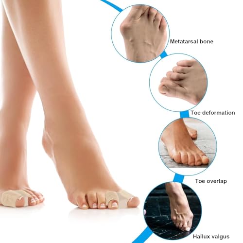 Image of LUVINA Gel Toe Separators for Bunions - Breathable Fabric Toe Spacers with Gel Lining for Bunion Pain Relief & Hammer Toe Correction - 2-Loop Design for Men & Women (1, S + L)