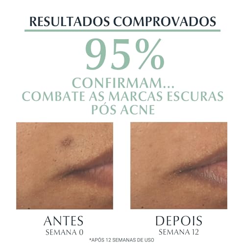 Sérum Facial Eucerin Dermopure Oil Control Efeito Triplo 40Ml