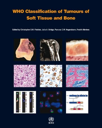 Who Classification of Tumours of Soft Tissue and Bone: WHO Classification of Tumours, Volume 5