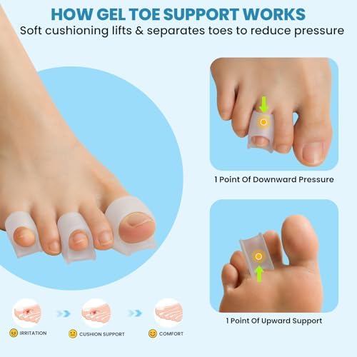 Hammer Toe Straightener - 6 Pcs Hammer Toe Corrector for Women & Men — 사진 3