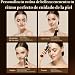 Imagen de ANLAN multipolar Radiofrecuencia Facial