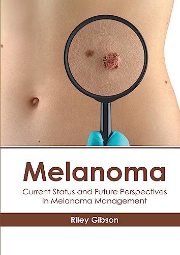 Melanoma: Current Status and Future Perspectives in Melanoma Management