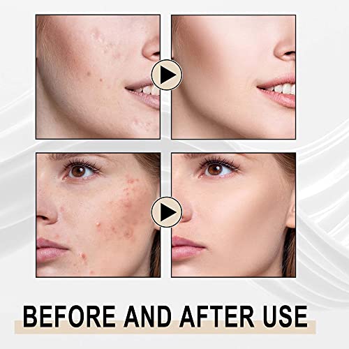 Habohuse 6093224346034 Papaya Whitening Deep Exfoliator, Papaya Whitening Deep Exfoliator, Papaya Essence Brightening Exfoliating Peeling Gel, Papaya Whitening Cream Papaya Exfoliating Scrub For Face And Body thumb #8