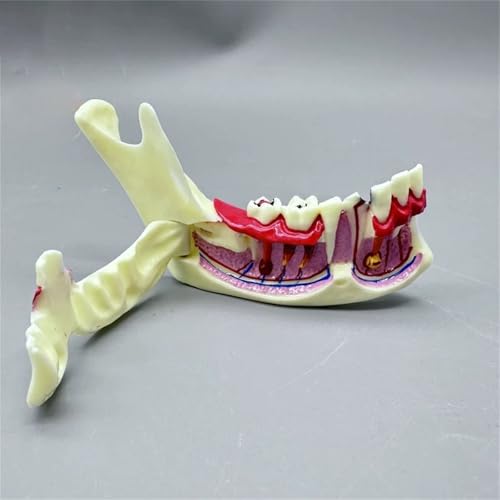 Modelo de anatomía de mandíbula desmontable y móvil para demostración médica 4