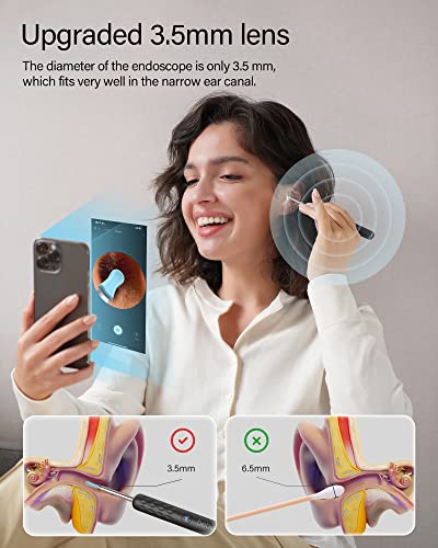 Ear Wax Removal,Bebird Ear Cleaner With Camera,Ear Wax Removal Tool Camera With 1080P Otoscope 6 Led Light, Ear Wax Removal Kit With 6 Ear Pick,3 Pcs Set,Ear Cleaning Kit For Ios & Android #TOP2