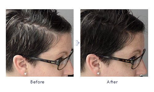 Miniatura 8 de Forila Corrector de pérdida de cabello de fibras de construcción de cabello, 0.81 oz - marrón oscuro