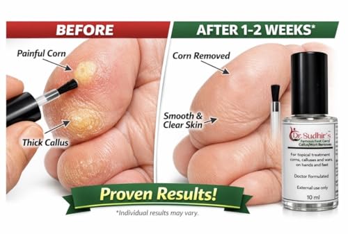 Image of Dr Sudhir's Famous Foot Corn /Callus /Wart Remover