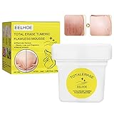 Creme für Dehnungsstreifen,Stretch Marks Cream Narbencreme, Narbencreme Entfernung Creme,Schwangerschaftsstreifencreme,Dehnungsstreifen Entfernen Creme, Reparatur Dehnungsstreifen Narben (30g)