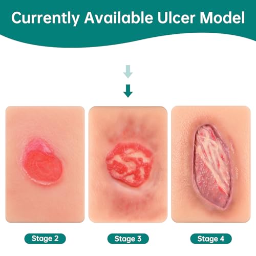 Image of Pressure Ulcer Wound Model Stage 3 Pocket Size