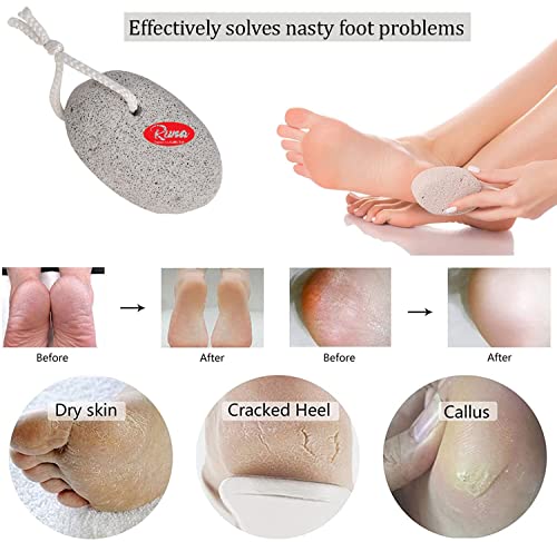 Image of Shower Cap Reusable Waterproof for Bathing Swimming (2)| Loofah for bathing Men and Women (2)| Body Wash Face Sponge (1)| Pumic Stone Foot Elbow Scrubber (1) Combo of 4 (unit 6)