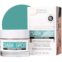 Advanced Clinicals Dark Spot Face Moisturizer | Lactic Acid Lotion For Face With Caffeine, Cocoa Butter, & Vitamin A | Brightening Cream Visibly Reduces Look Of Dark Spots & Uneven Skin Tone, 2 Fl Oz