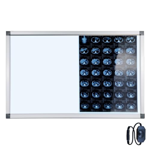 Ultradünne LED-Lichtbox for Röntgenfilme, Tragbarer LED-Röntgenfilmbetrachter, Einstellbare Helligkeit, for Kliniken und Krankenhäuser(Large) Ultradünne LED-Lichtbox for Röntgenfilme, Tragbarer LED-Röntgenfilmbetrachter, Einstellbare Helligkeit, for Kliniken und Krankenhäuser(Large)
