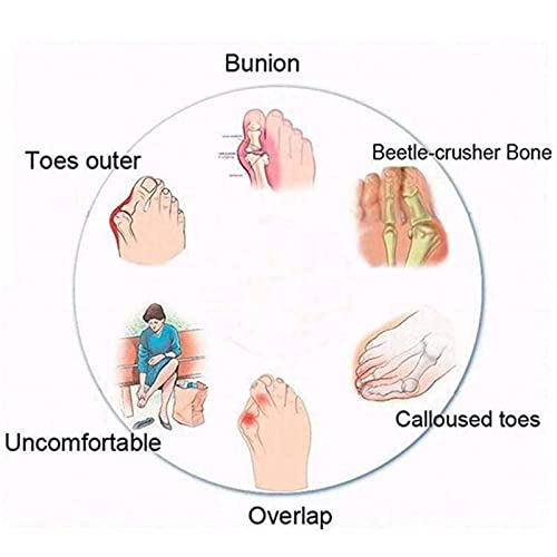 BIAJIAZHUA Correzione del Piede Infradito