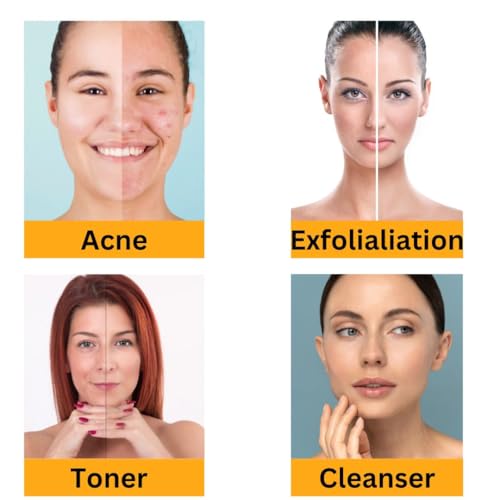 Image of Glycolic Acid 70%, Lactic Acid 88%, Cosmetic-Grade Solutions for Making DIY Skin Care - Toner, Soap, Serum 100ml Each (Pack of 2)