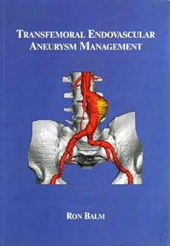 Paperback Transfemoral Endovascular Aneurysm Management Book