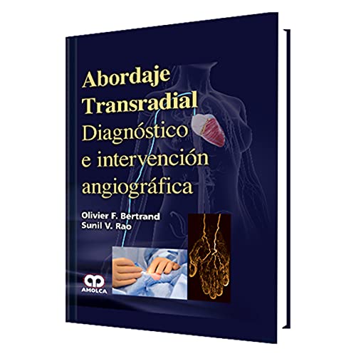 Abordaje Transradial