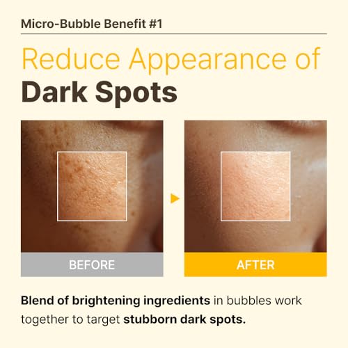 MENOKIN-30-Seconds-Quick-Bubble-Mask-BRIGHT-Vitamin-C-Glutathione-Niacinamide-in-Micro-bubbles-for-Dark-Spots-Uneven-Skin-Tone-Korean-Skin-Care-Essential-70-Uses-321-floz