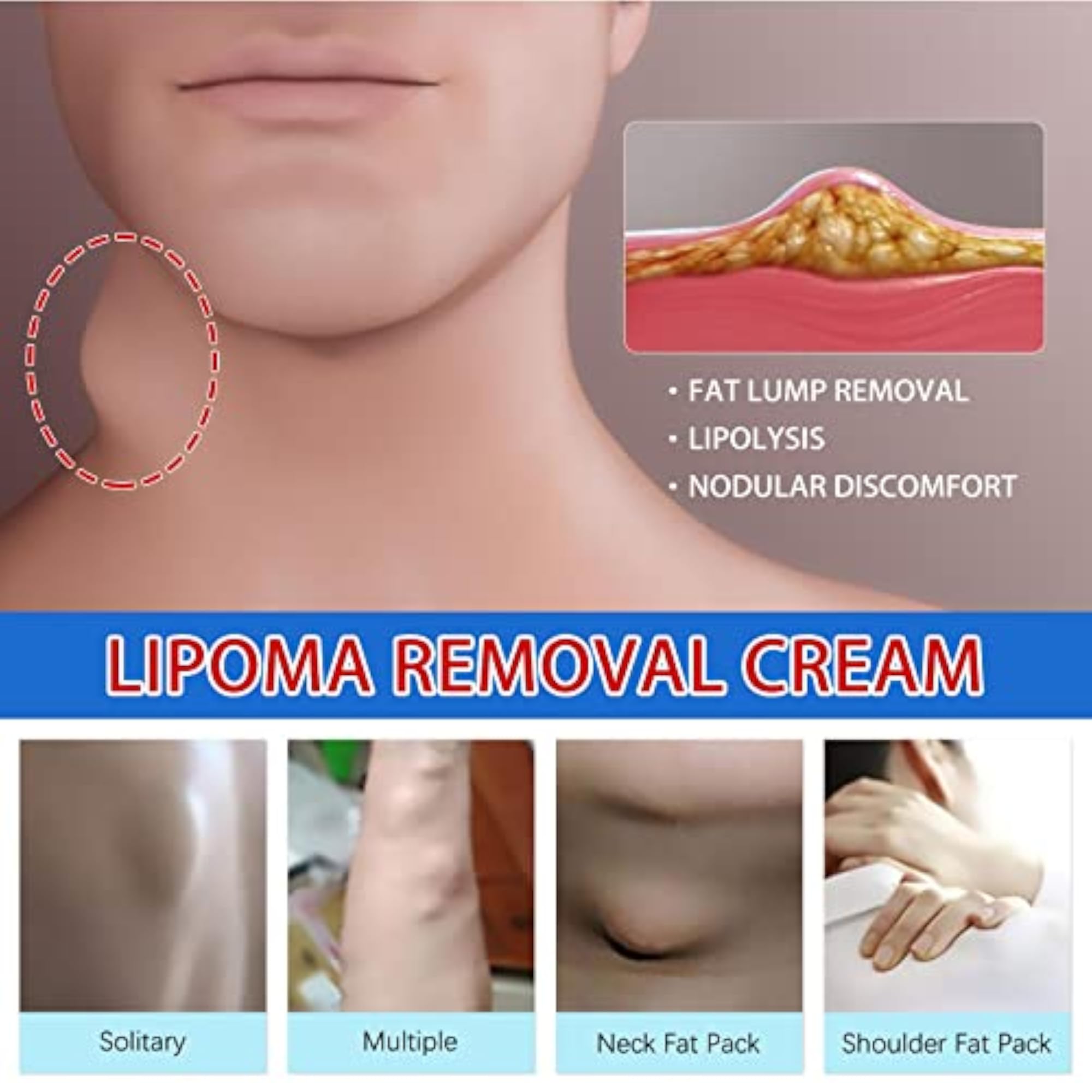 LOOM TREE 20g Lipoma Removal Cream, Herbal Care Cream