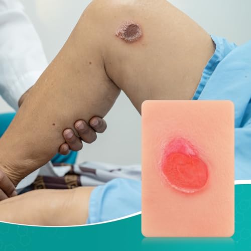 Image of Pressure Ulcer Wound Model Stage 4 Pocket Size, Wound Packing Trainer for Medical Education, Wound Care Demonstrations Tool