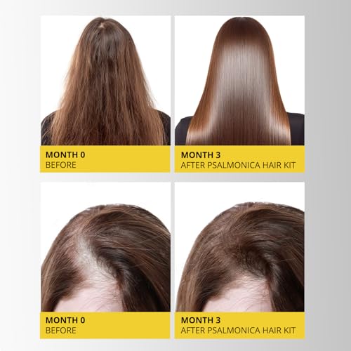 Image of Hair Growth Shampoo and Conditioner Set: Sulfate Free Hair Growth Root Activator Thickening Shampoo for Hair Loss and Thinning Hair - Hair Loss RegrowthTreatments for Women Men