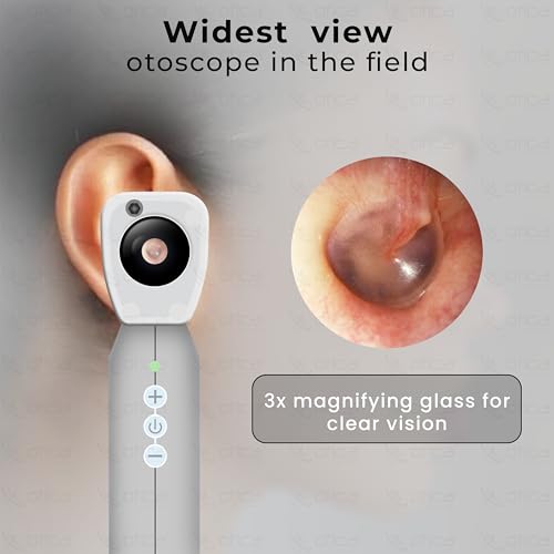 Image of OTICA 3.7V Professional Diagnostic Pocket LED Otoscope | Rechargeable In-Built 3500mAh Battery | Type-C Charging | Adjustable Intensity | 10 Disposable Specula + Spare Glass | 11707 - White
