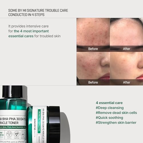 SOME-BY-MI-AHA-BHA-PHA-30Days-Starter-Kit-Toner-101Oz-Serum-033Oz-Cream-07Oz-Cleansing-Bar-105Oz-Mild-Exfoliating-Daily-Skin-Care-Set-Acne-Sebum-and-Oiliness-Care-Korean-Skin-Care