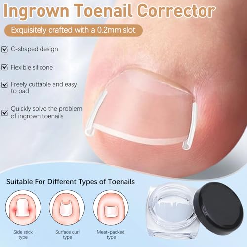 Professional Ingrown Toenail Corrector Set with Breathable Ingrown Toenail Strips,Upgraded Ingrown Toenail Removal Kit,Curved Toenails Corrector Patch,Pedicure Tools,Ingrown Nail Tool for Home Use