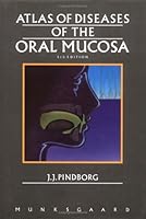 Atlas of Diseases of the Oral Mucosa 8716105850 Book Cover