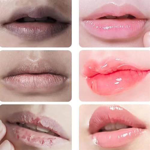 Generic Lip Lightening for Dark Lips, Lip Brightening for Dark Lips, Dark Lip Treatment Serum for Smokers, Dry or Uneven, Restores Natural Look & Moisture with VC, Licorice & Jojoba Seed Oil