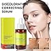 Dark Spot Remover for Face Body: Dark Spot Corrector Face Serum for Age Spot Sun Spot Freckles Brown Spot for Women & Men - 30m
